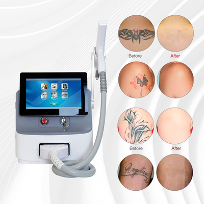 Q Switch Nd YAG Máquina de remoção de tatuagens a laser 1064nm 532nm 1320nm 2 anos de garantia