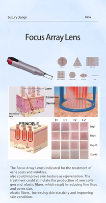Tudo em um de Picosecond Laser depilação e ND YAG Laser de remoção de tatuagens máquina