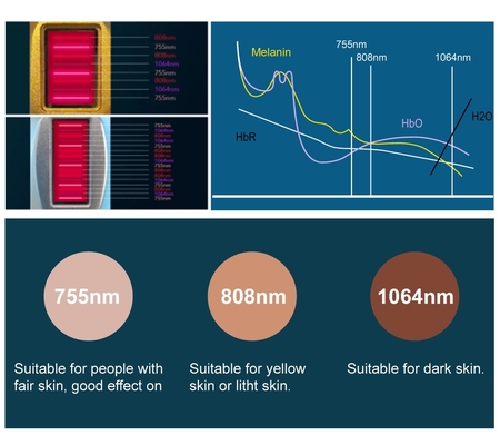 Máquina de remoção de cabelo sem dor de 4 ondas de diodo a laser 755nm 940nm 1064nm