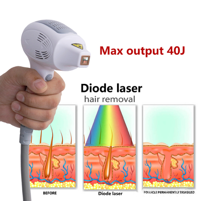 Mini Máquina de Laser de Diodo Portátil Máquina de Depilação de Estilo Fixo