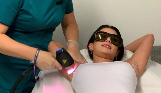 Máquina de remoção de pelos a laser de diodo Laser Titânio 755/808/1064nm ICE
