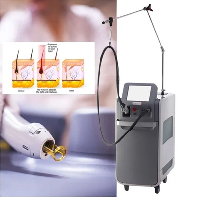 Extirpação de cabelo de longa duração Weifang KM 755nm Alexandrite 1064nm ND YAG Laser de pulso longo