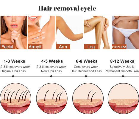 Salão de beleza Máquina de remoção de cabelo a laser IPL RF Cuidados da pele Remoção de tatuagens