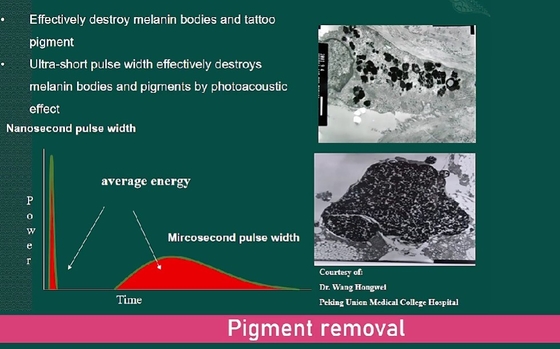 Máquina de remoção de tatuagens a laser por picossegundo de estilo estacionário 2000W Q commutada Nd YAG