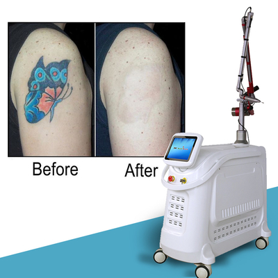 4 comprimentos de onda Nd YAG Q Switch Laser Machine Remoção de tatuagens Estilo estacionário