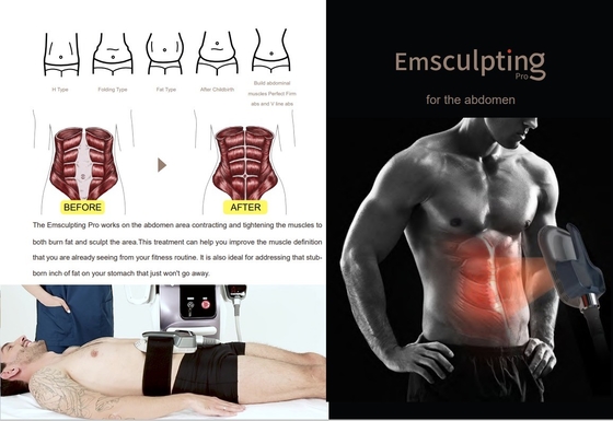 Máquina de emagrecimento comercial EMS de tela sensível ao toque de 10 polegadas para salão de beleza / spa