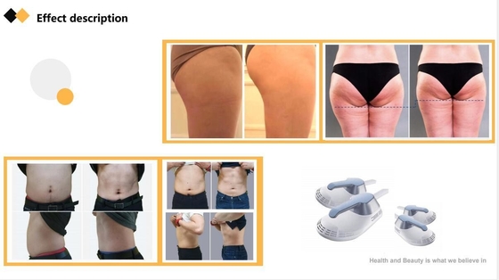 Máquina de escultura corporal ABS EMS Estimulador muscular EMS elétrico comercial