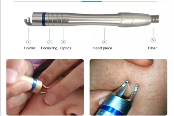 Máquina de remoção vascular a laser de 15W 30W para tratamento de unhas dos pés / rejuvenescimento da pele a laser quente