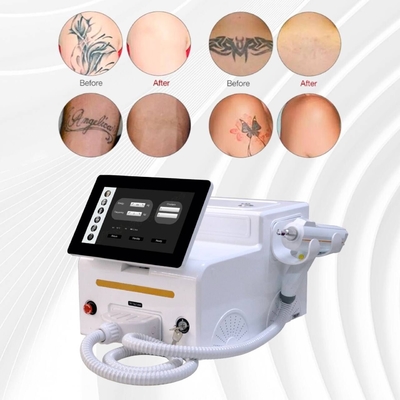 Máquina de Tratamento Laser de Fungos para Branqueamento de Pele de unhas 1064nm 532nm 1320nm comprimentos de onda