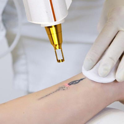 Máquina de Tratamento Laser de Fungos para Branqueamento de Pele de unhas 1064nm 532nm 1320nm comprimentos de onda