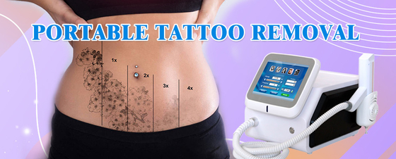 Máquina médica de remoção de cabelo Nd YAG 1064nm 532nm Equipamento de remoção de tatuagens a laser