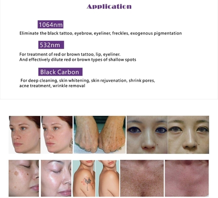 Multifuncional OPT IPL RF ND YAG Máquina de remoção de cabelo a laser com tela sensível ao toque de 15 polegadas