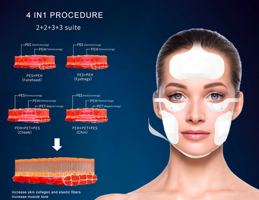 Ems faciais magnéticos verticais Rf Rejuvenescimento da pele Elevação da pele Apagamento da pele Emagrecimento Rf Elevação Máquina machifor sal