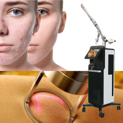 Máquina de remoção de estrias